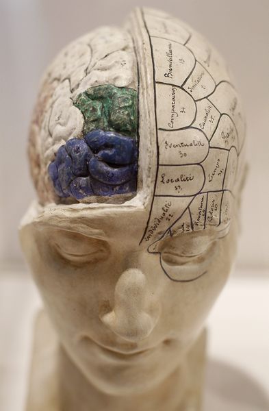 Мозг Альберта Эйнштейна как экспонат музея 